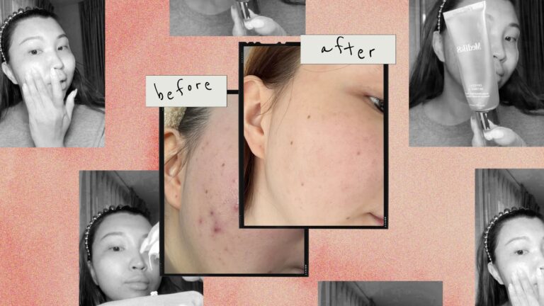 best retinol serums 2025